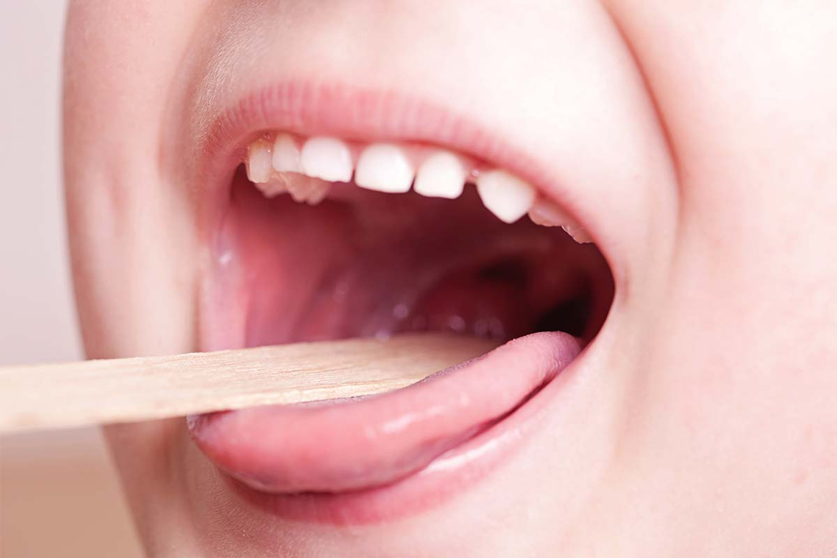 The simple remedy that could slash the number of child tonsillectomies by almost half