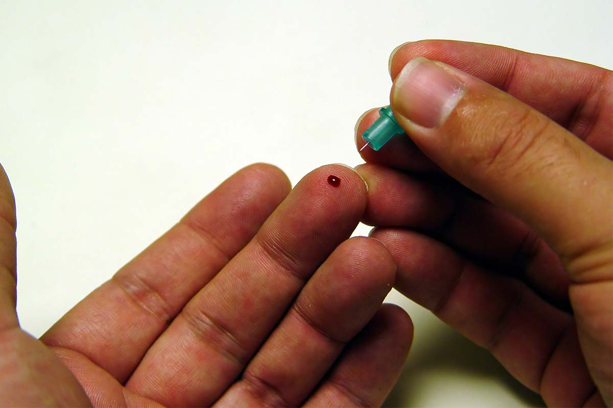 New at-home test to diagnose life-threatening disease