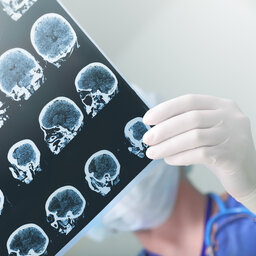 Why a head trauma expert says helmets make 'concussion and brain trauma worse'