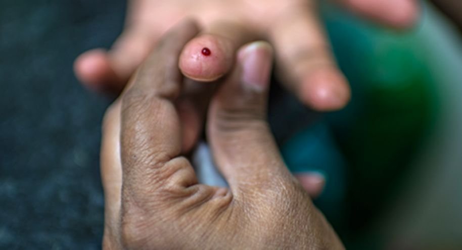 Día Mundial de la Diabetes: ¿Cómo evitar la ceguera causada por esta enfermedad??