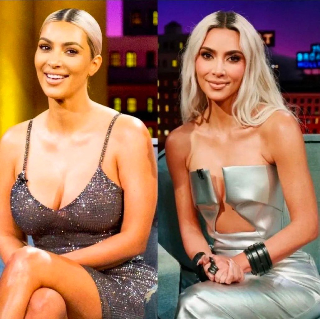 Kim K Had Her Body Implants Removed