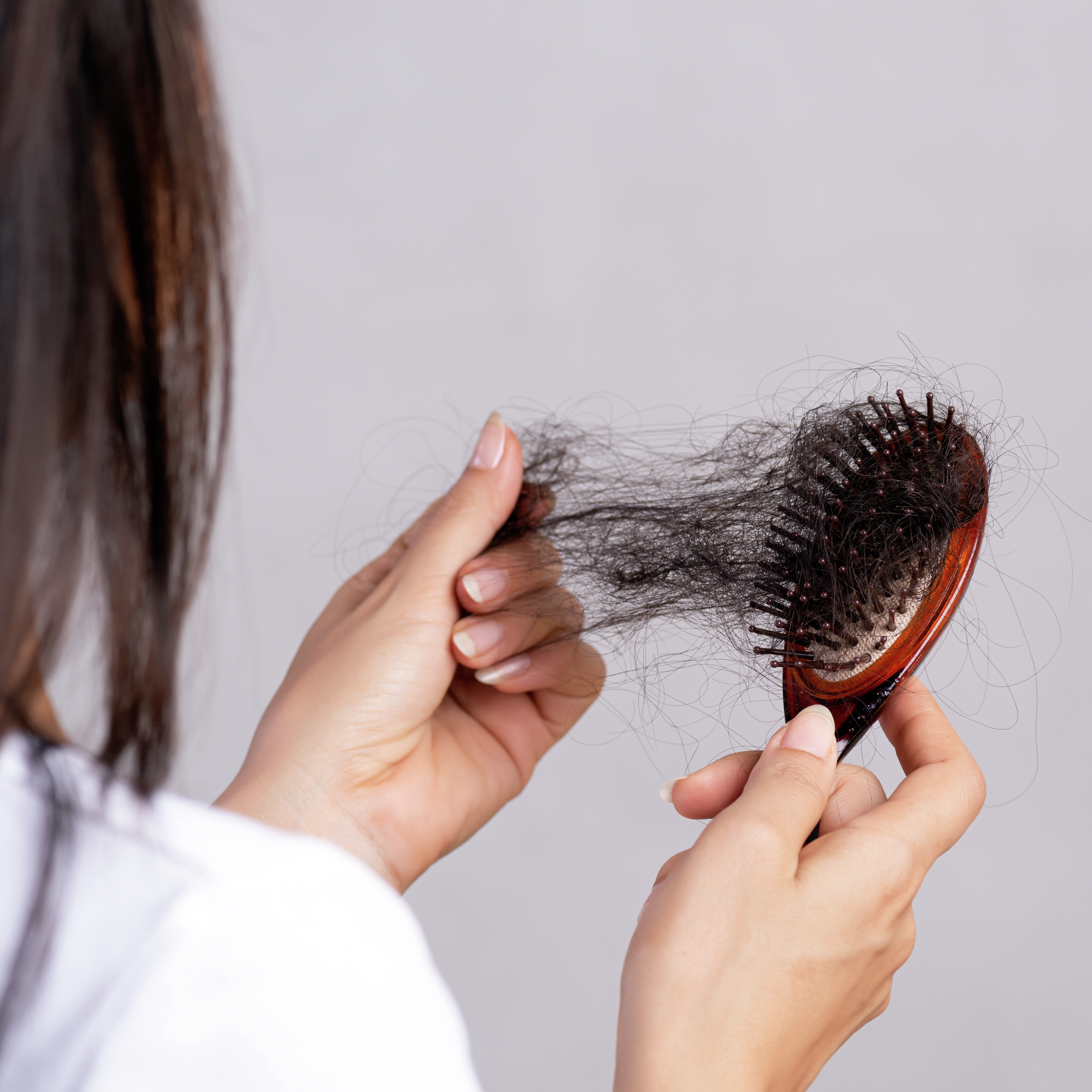 Ma en dogter se pad met alopesie