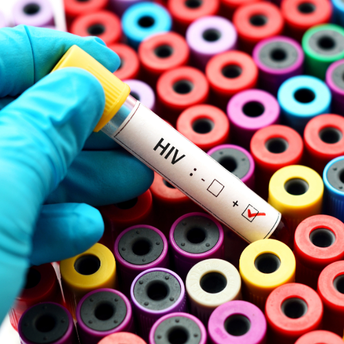 SA stel baanbreker MIV-voorkomingsinspuiting bekend