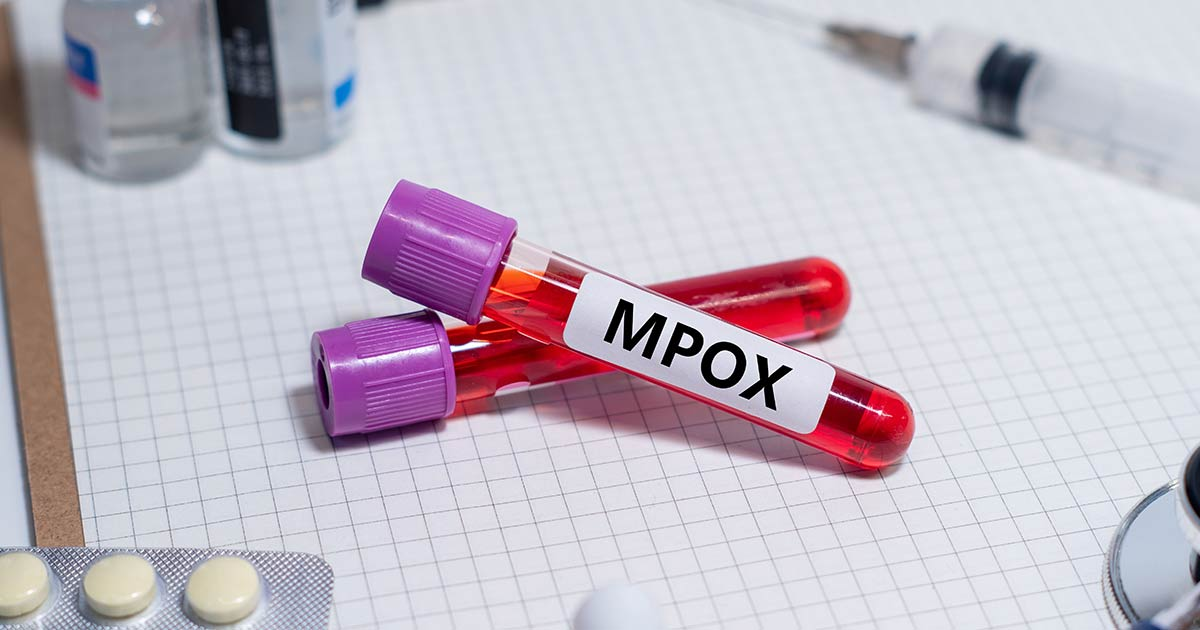 #PODCAST Health Minister Joe Phaahla calls for calm after the outbreak of Mpox in Gauteng and KZN #sabcnews episode artwork