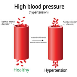 #PODCAST Young South Africans advised to get their blood pressure tested to avoid being another statistic of hypertension #sabcnews