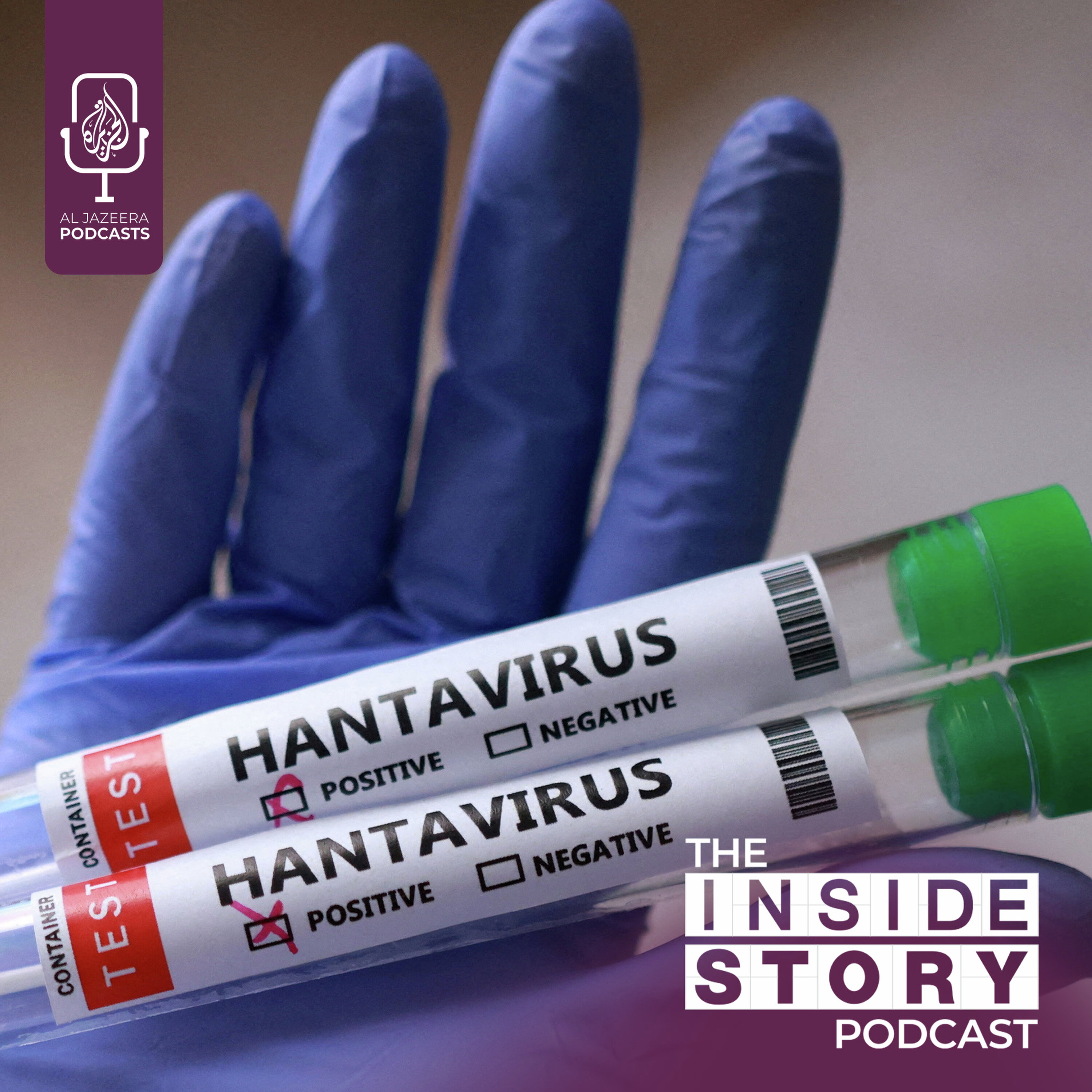 How the Covid-19 pandemic experience could help deal with Hantavirus? How the Covid-19 pandemic experience could help deal with Hantavirus?
