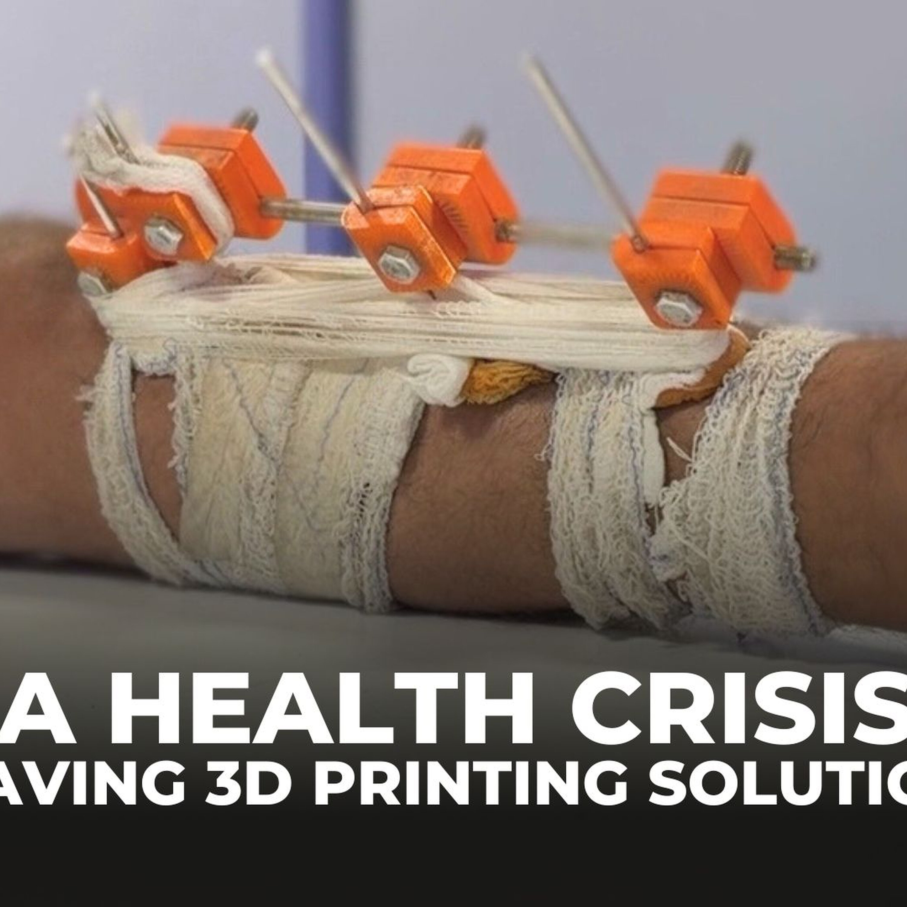 Gaza doctors use solar‑powered 3D printing to save limbs and lives Gaza doctors use solar‑powered 3D printing to save limbs and lives