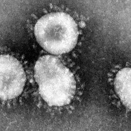 LISTEN: CORONAVIRUS by CITY/COUNTY - (April 10) The latest local numbers
