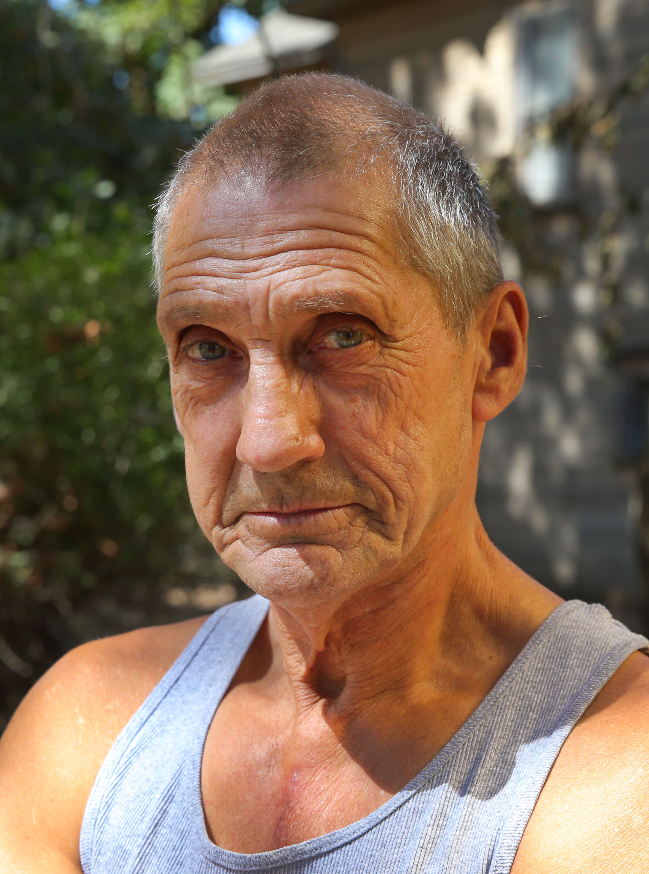 Wayne Wiser: "They found a piece of barbed wire embedded in the backside of my heart."