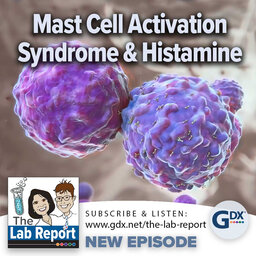 Mast Cell Activation Syndrome & Histamine