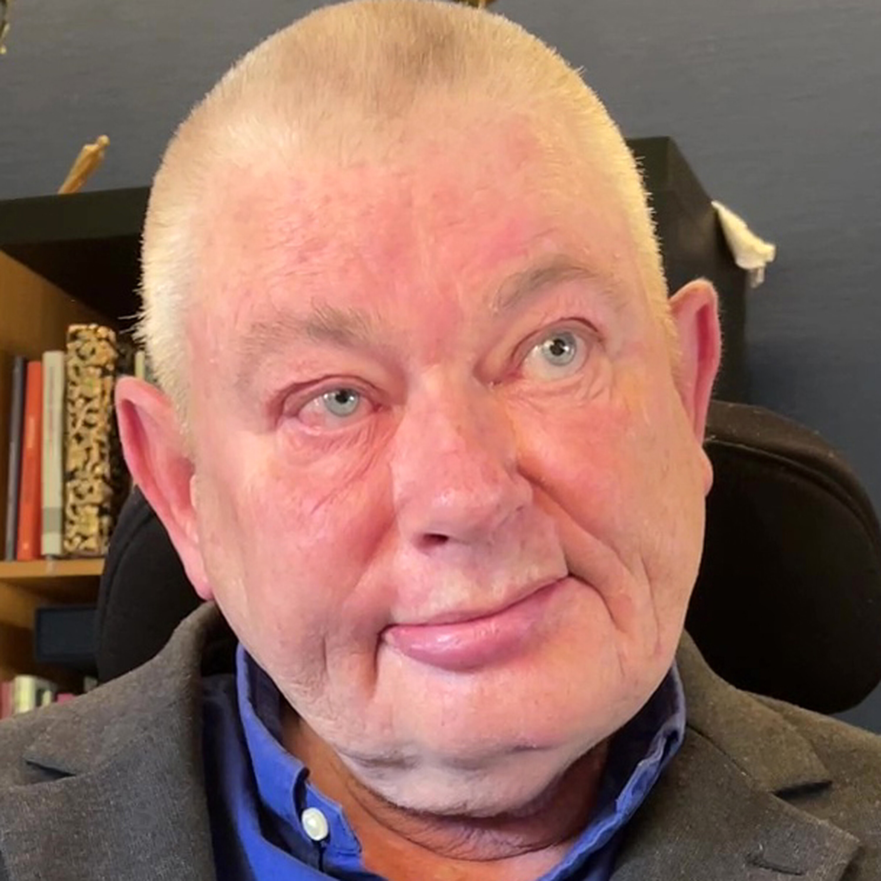 Legen sa stopp, men Thorvald Steen ville ha et siste skihopp. – Brakk begge beina Legen sa stopp, men Thorvald Steen ville ha et siste skihopp. – Brakk begge beina