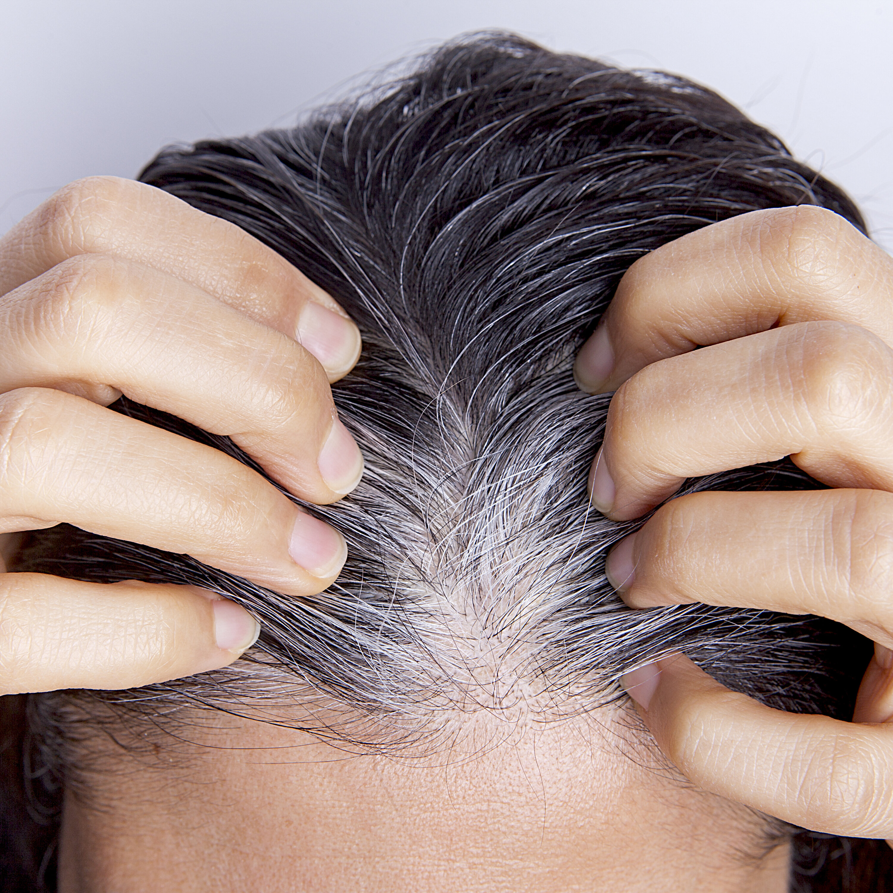 Le stress et les cheveux blancs (EN REDIFFUSION)
