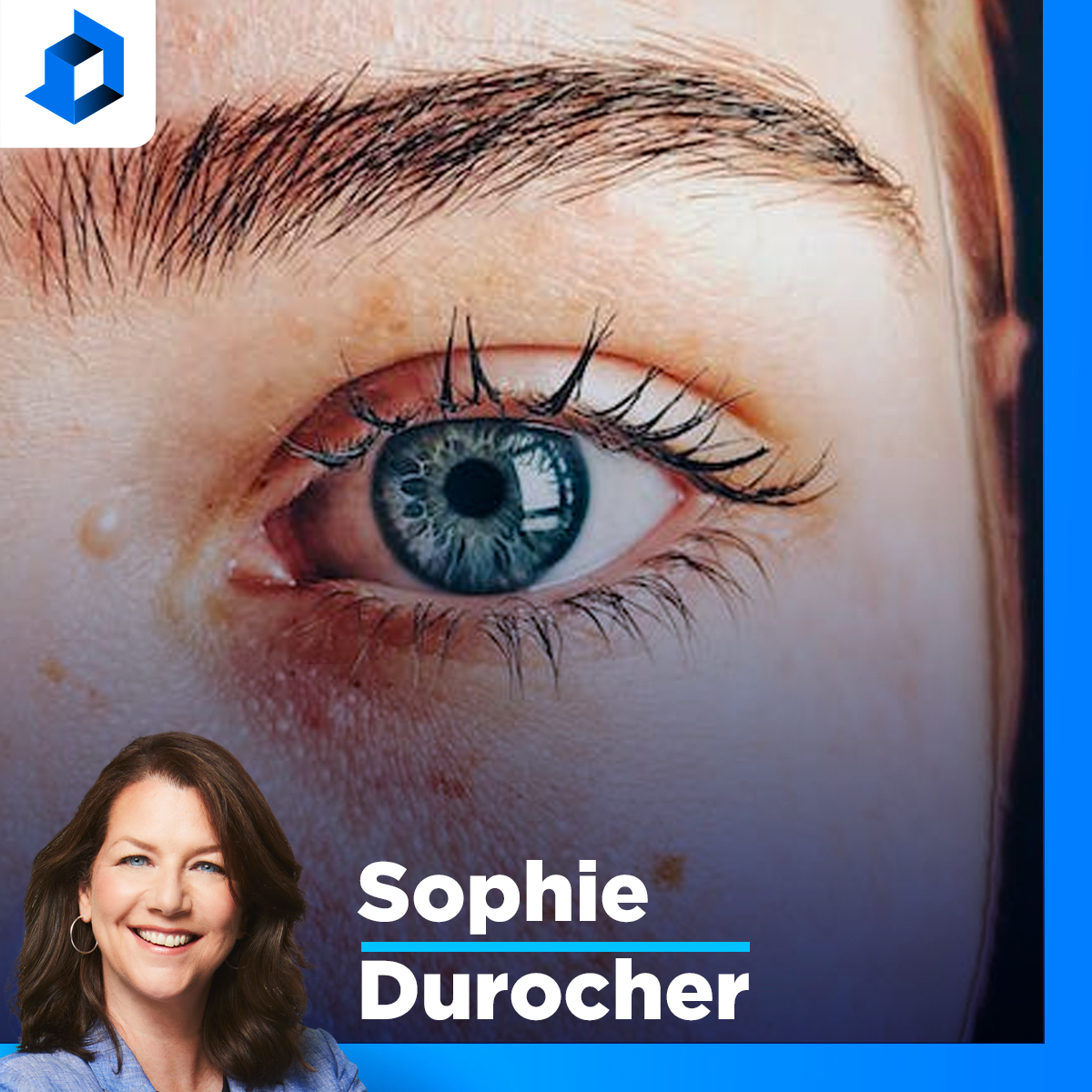 Correction de la vue : «Il n’y a pas de chirurgie sans risque», dit Dr Langis Michaud