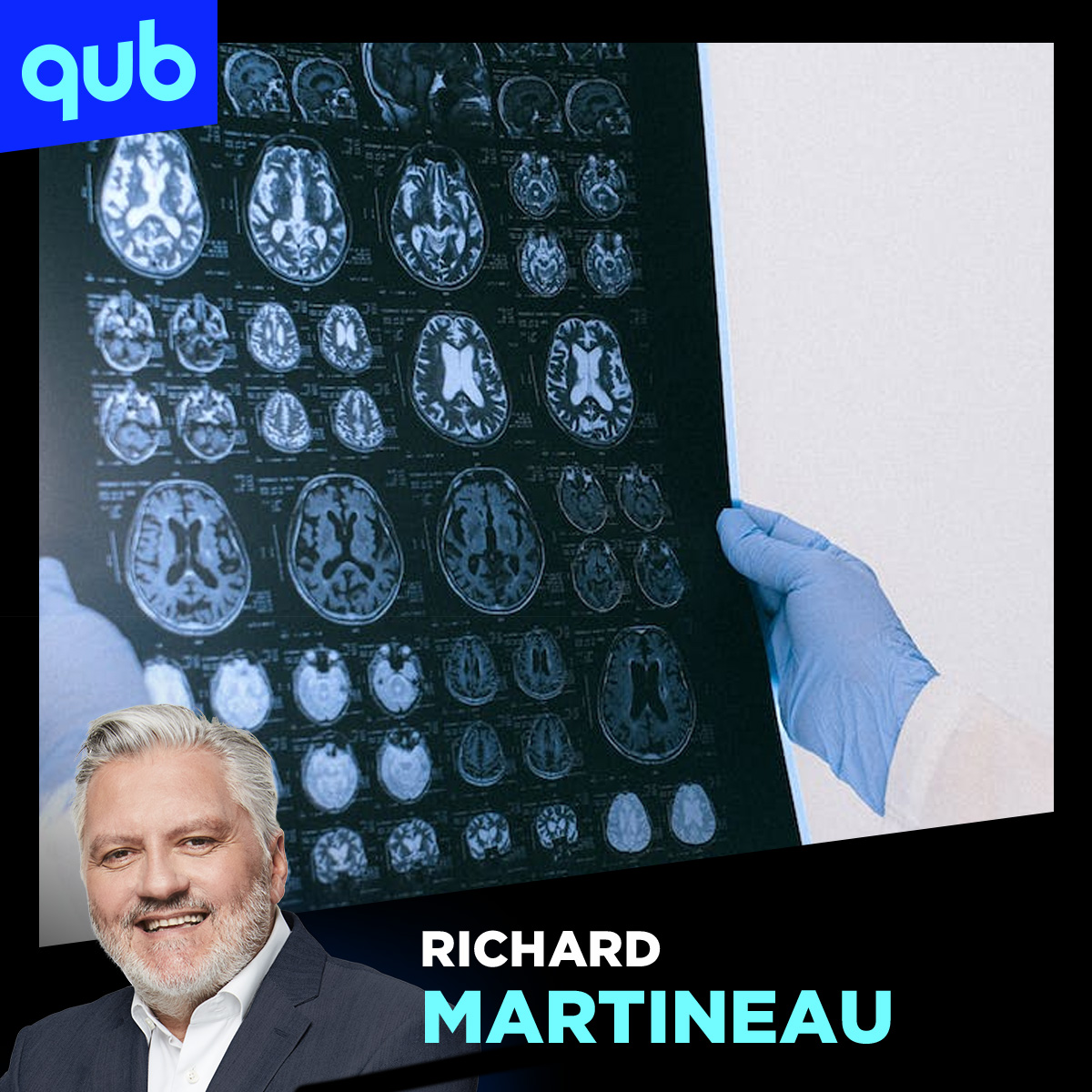 Vers une augmentation de 145% des troubles neurocognitifs au Québec