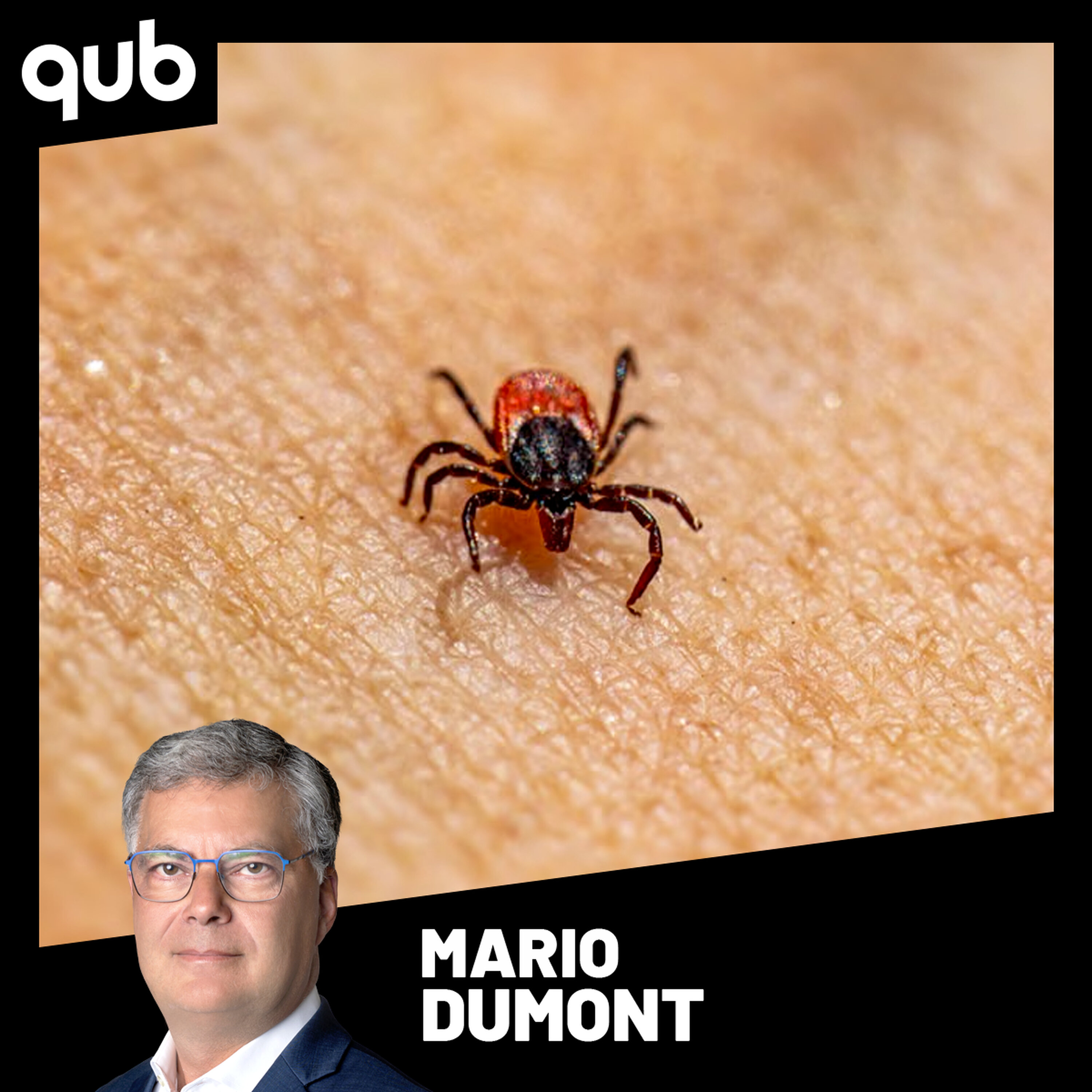 Ce père de famille est devenu invalide en raison de moustiques et de tiques!