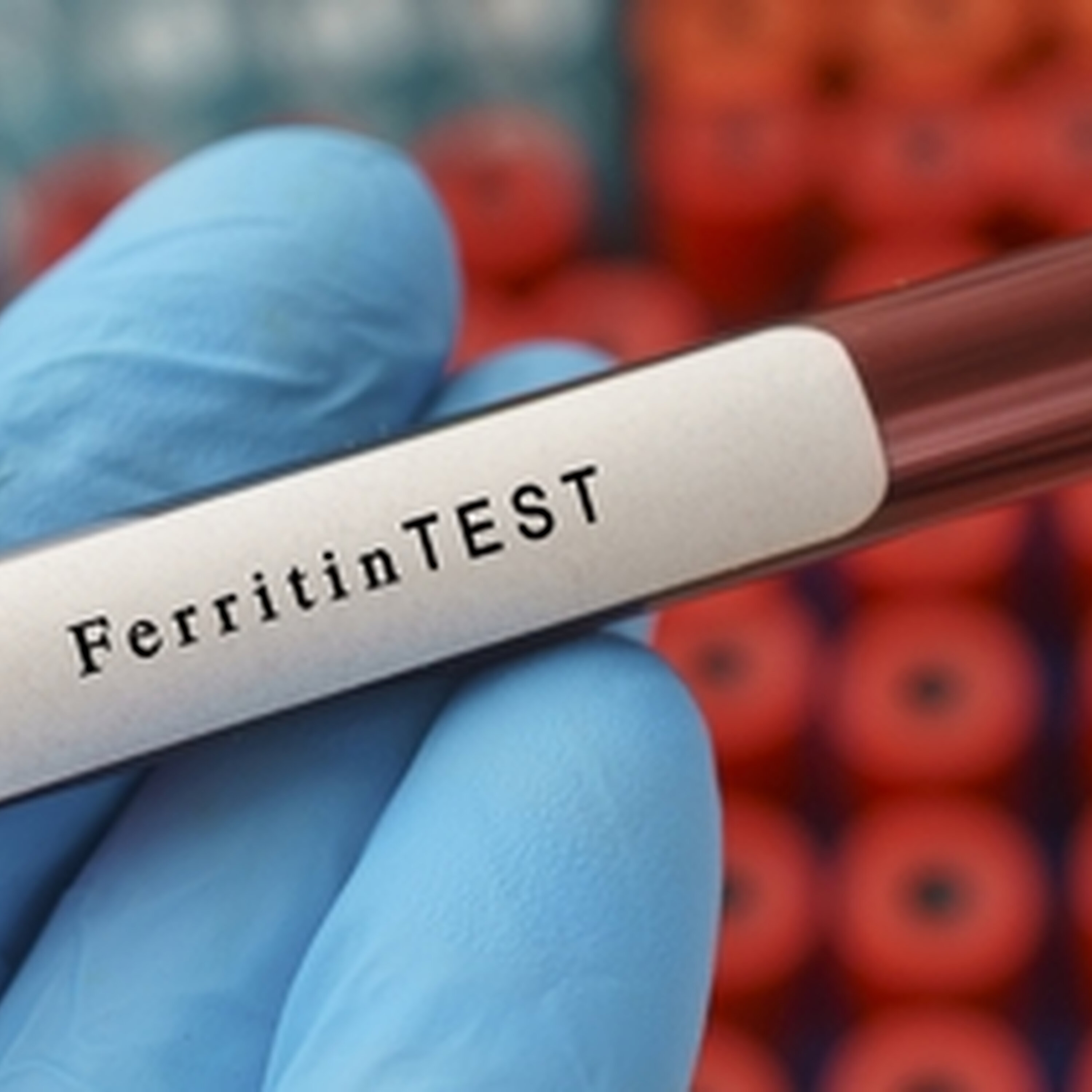 Sarah Keogh - Ferritin Face