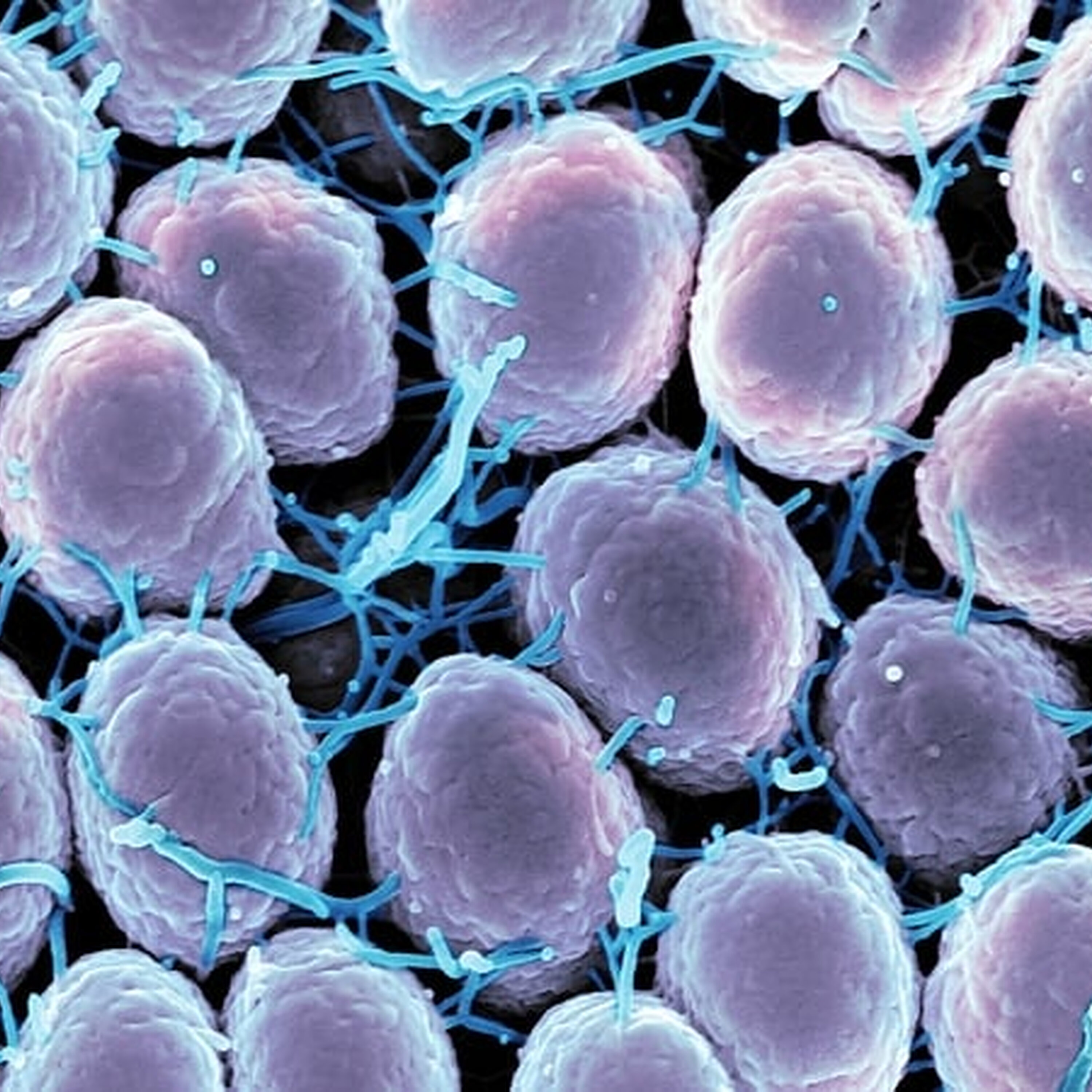 Over 20,000 cases of sexually transmitted diseases reported last year Over 20,000 cases of sexually transmitted diseases reported last year