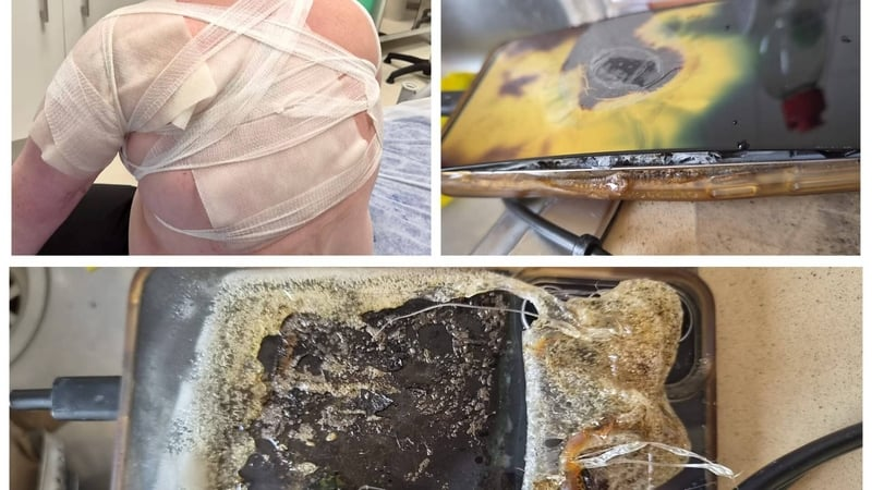"It [the phone] fused into his skin, under his shoulder blade"