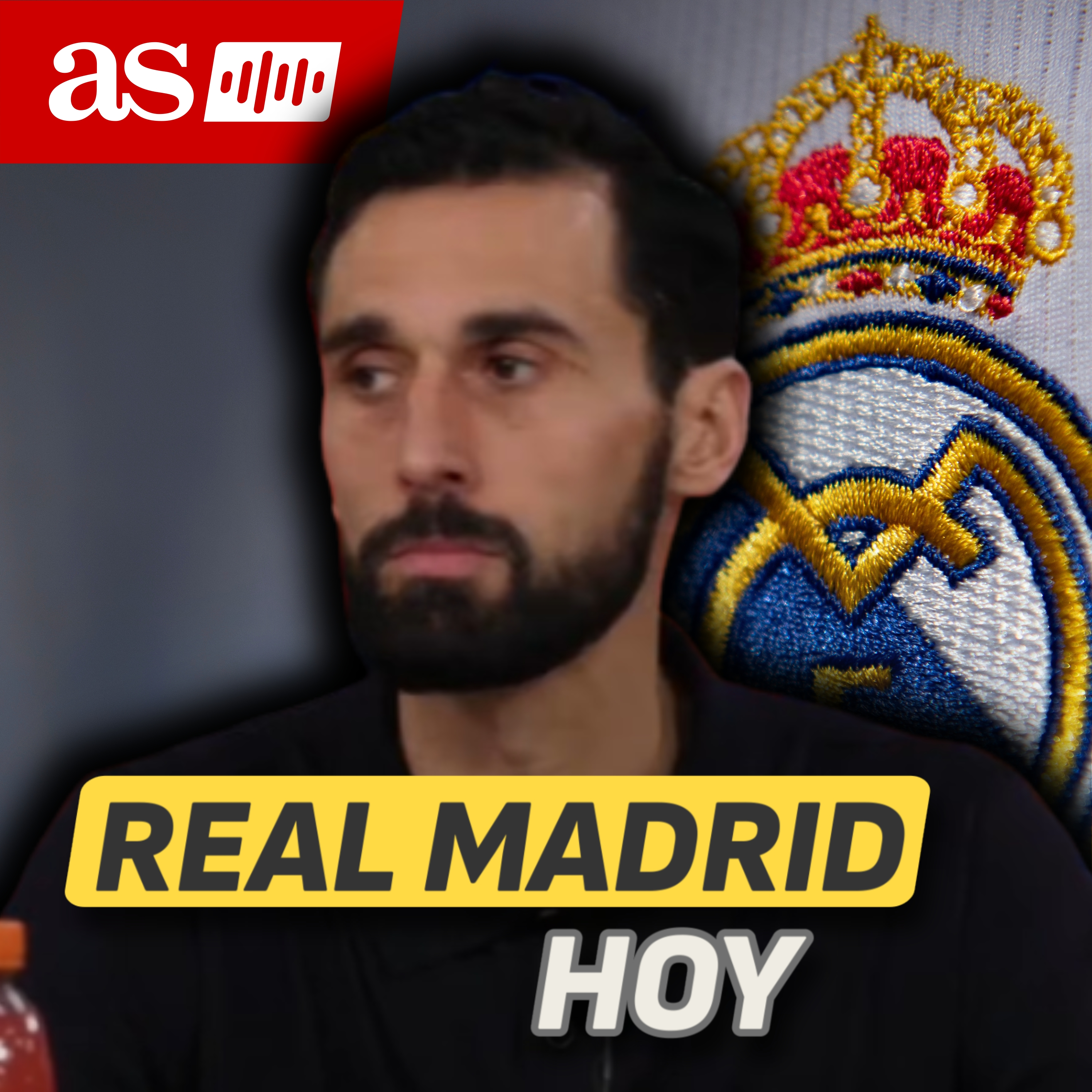 Imagen de Álvaro Arbeloa busca explicaciones en rueda de prensa tras la gravísima derrota ante Benfica en Champions League