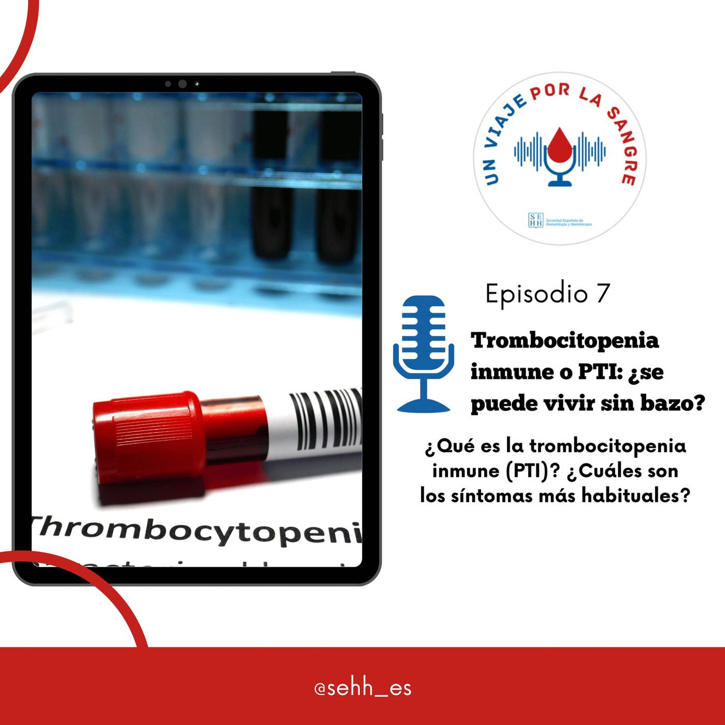 7. Trombocitopenia inmune o PTI: ¿se puede vivir sin bazo? episode artwork
