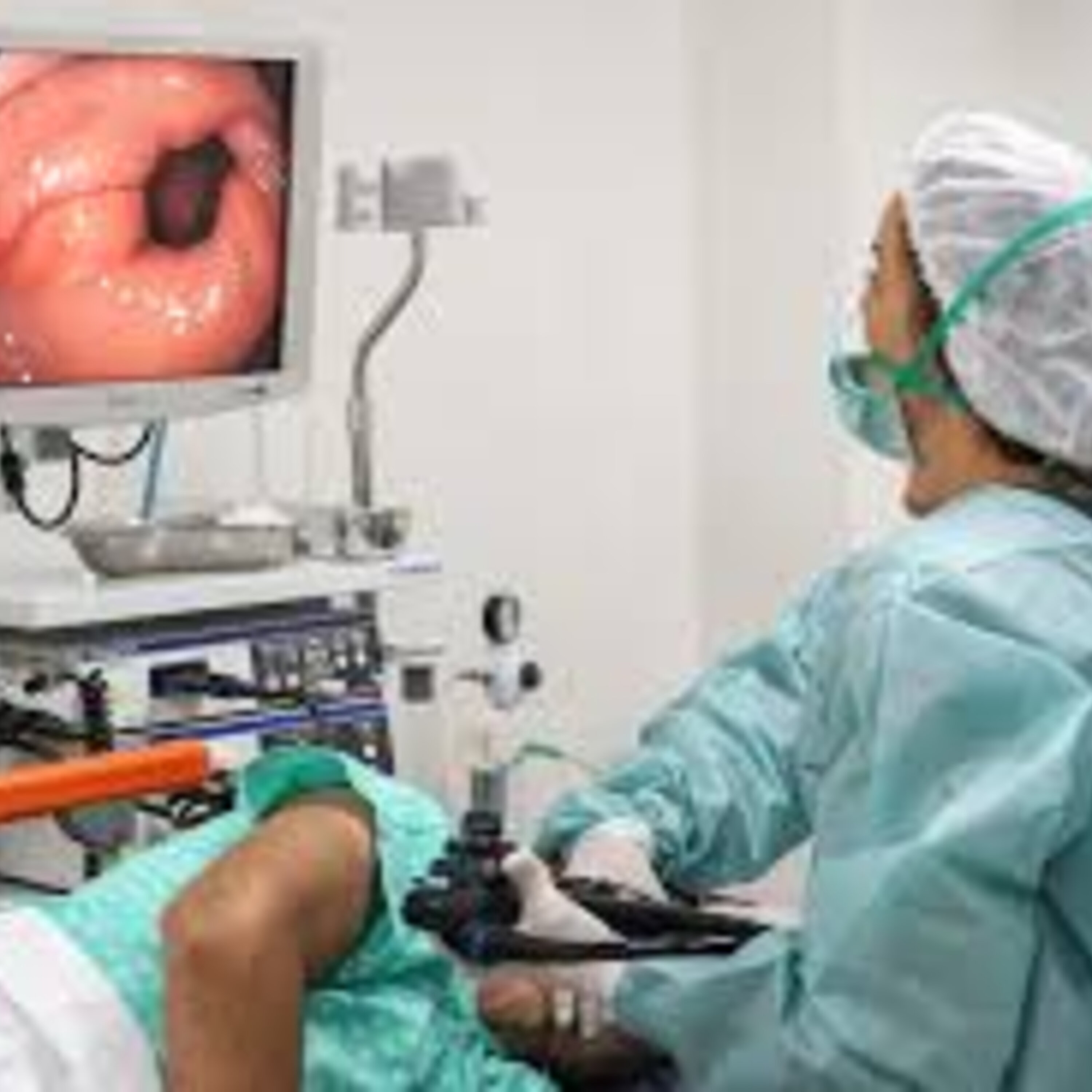 Endoscopia