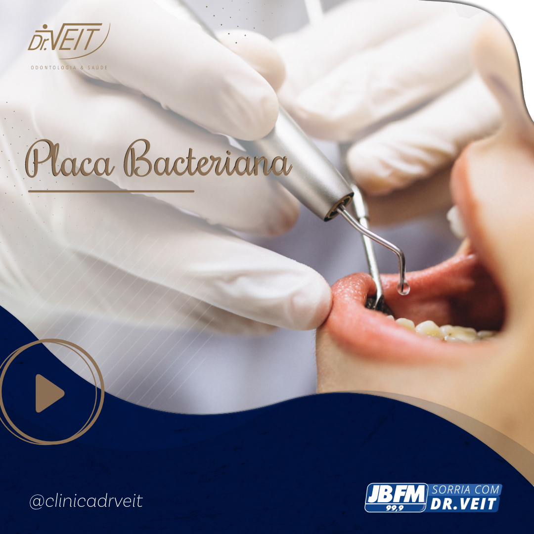 Placa bacteriana