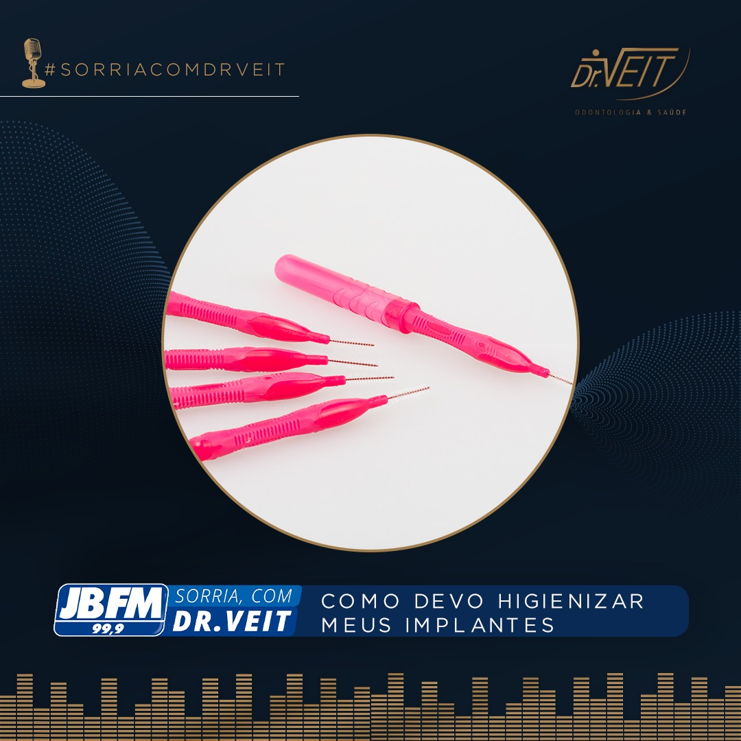Como devo higienizar meus implantes?