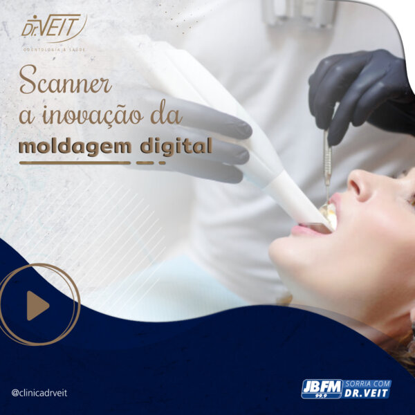 Scanner odontológico: a inovação da moldagem digital