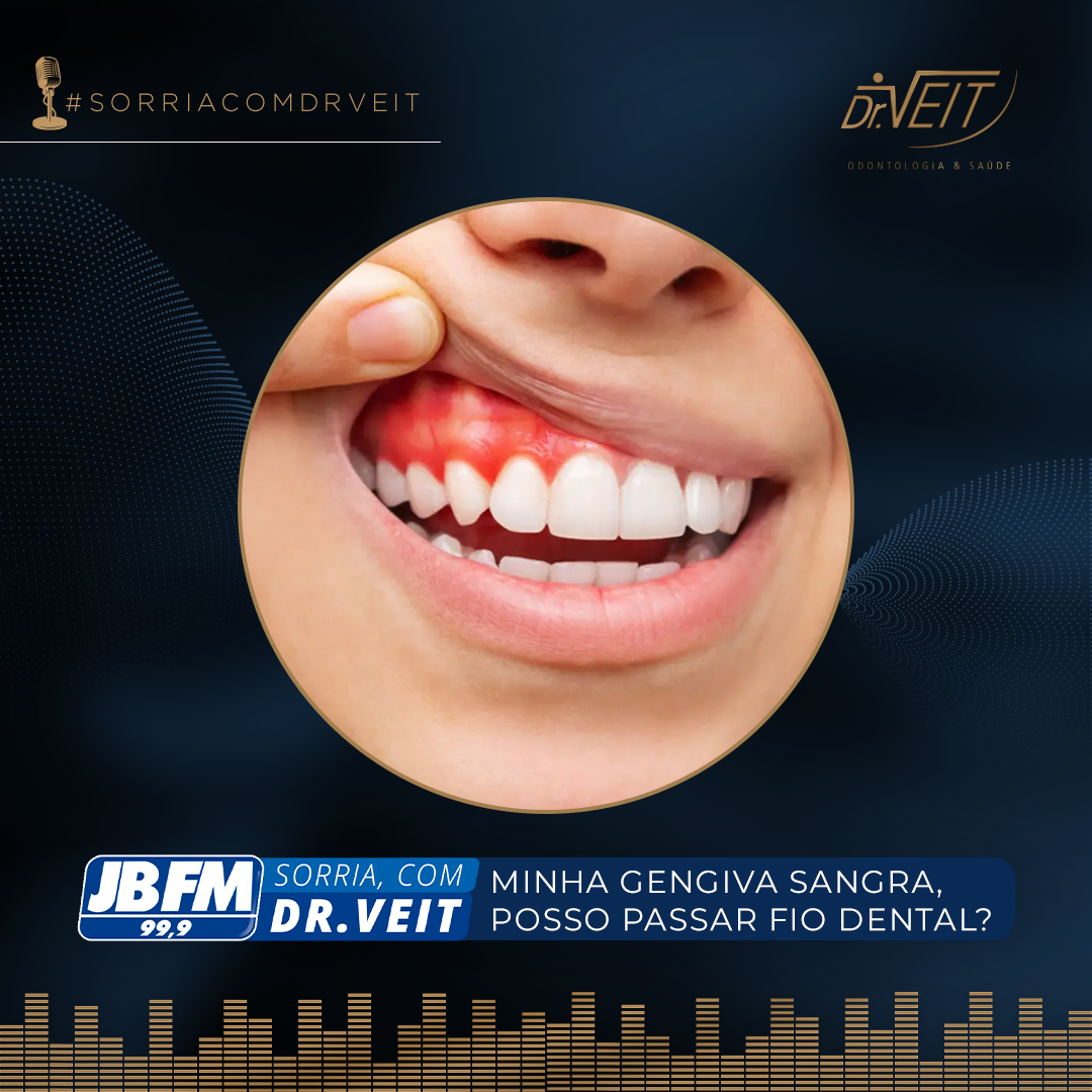 Posso usar fio dental em caso de sangramento na gengiva?