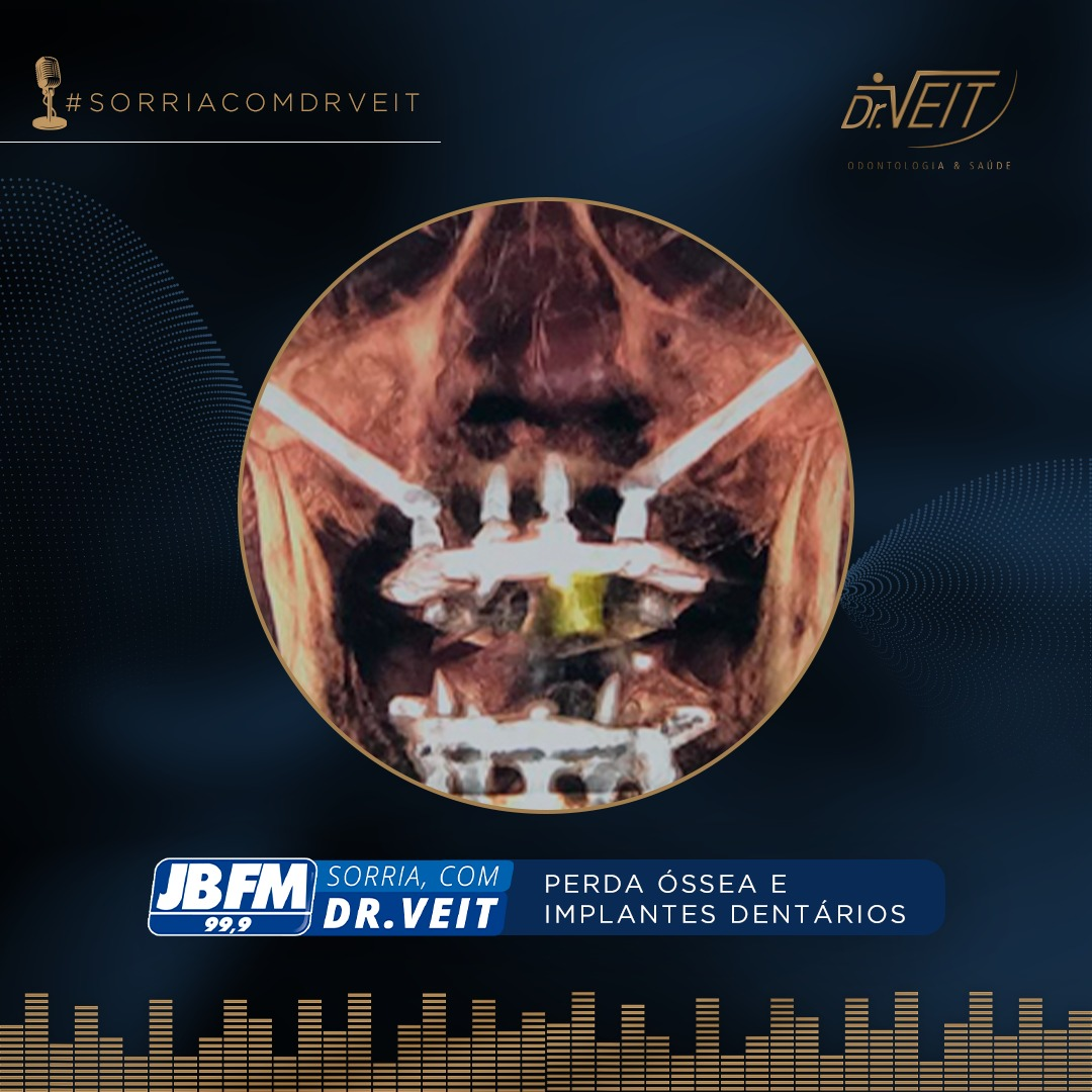 Perda óssea e implantes dentários