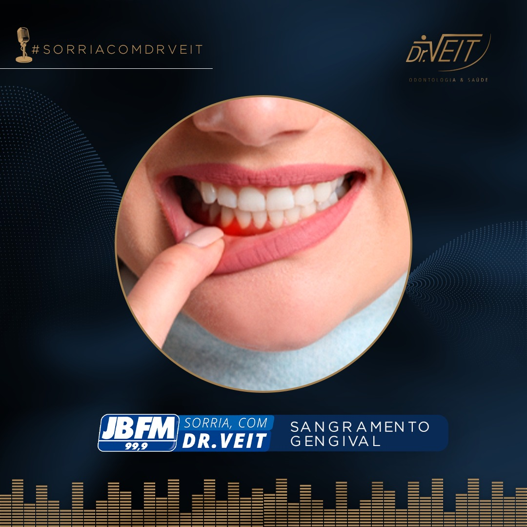 Sangramento gengival