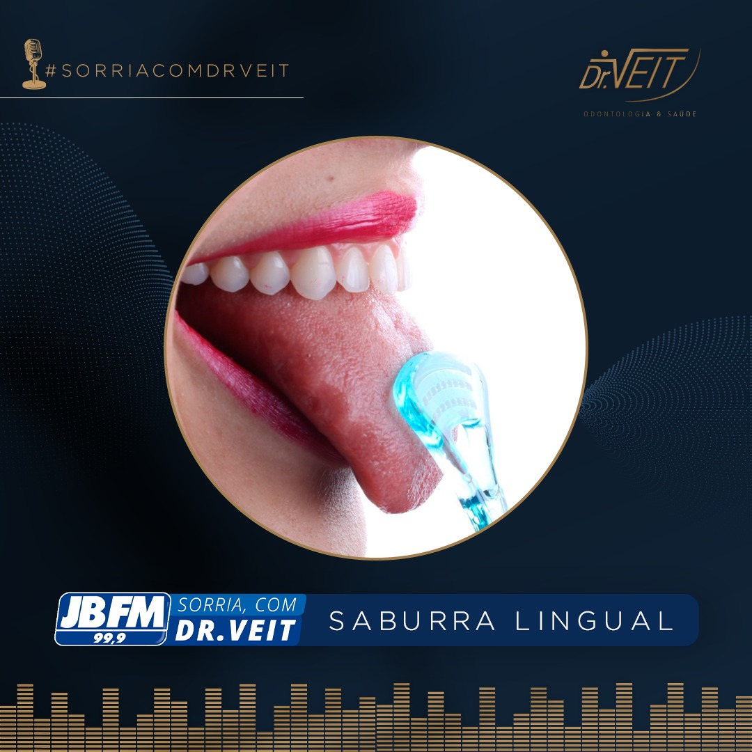 Você sabe o que é Saburra Lingual?