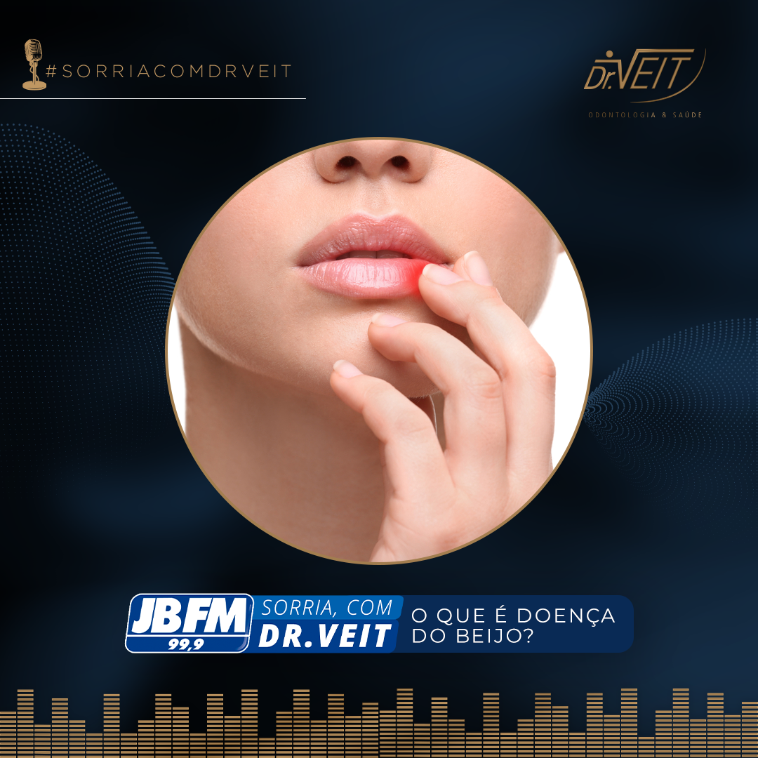 Você já ouviu falar na doença do beijo?