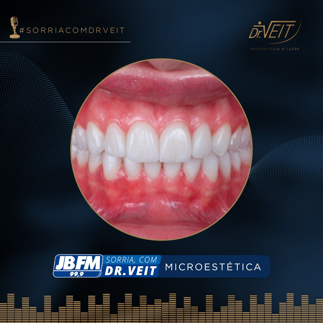 Microestética