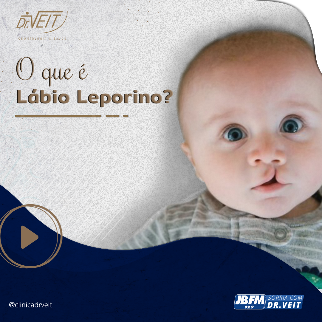 Lábio leporino