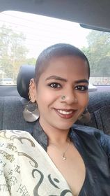 Women and Hair Loss - Ishita Kumar