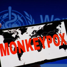 Hard Work In Addressing The Stigma Over Monkeypox 