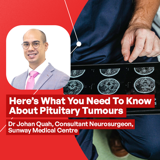 Here’s What You Need To Know About Pituitary Tumours