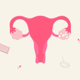 Understanding PCOS and How It Affects Women’s Bodies 