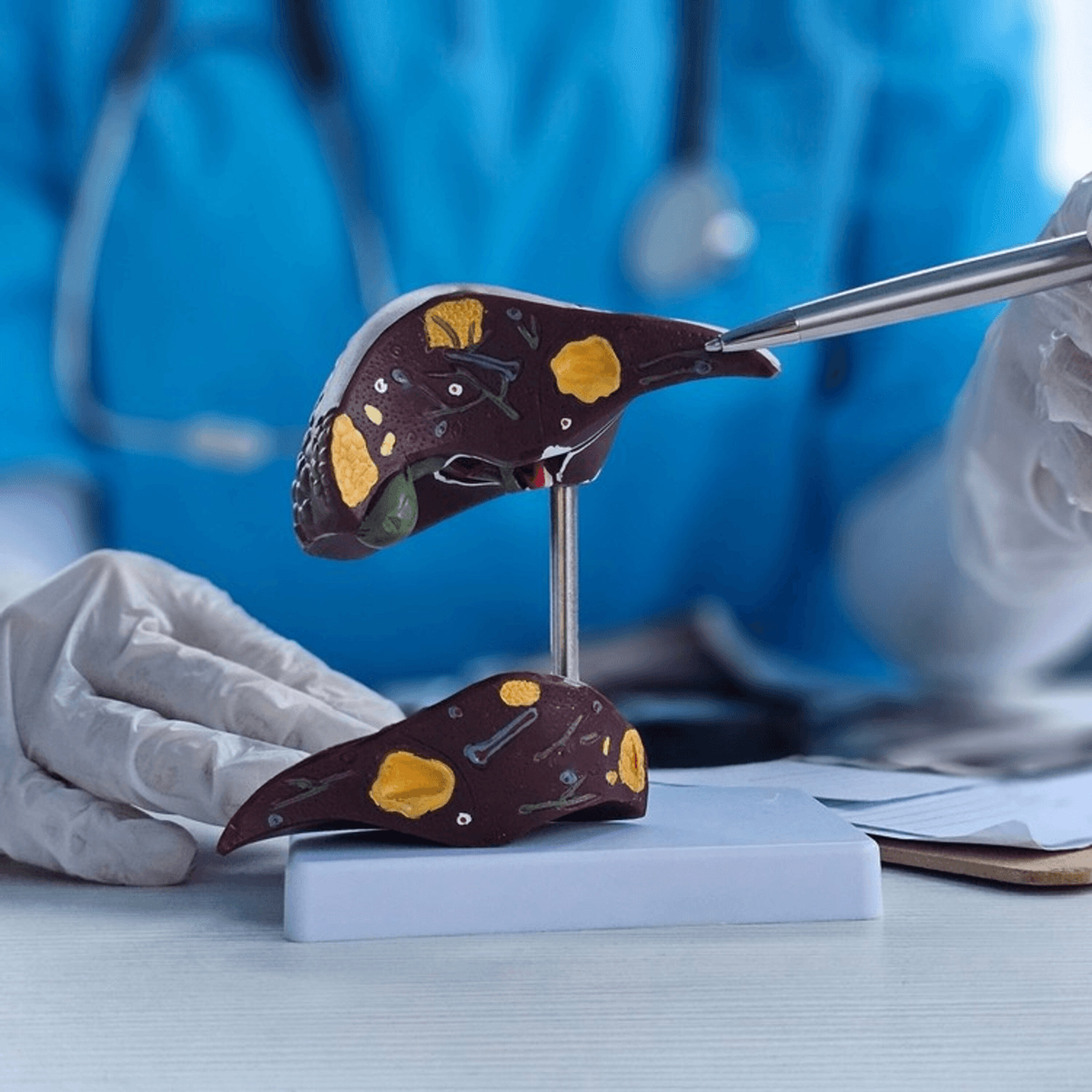 What To Do About A Fatty Liver