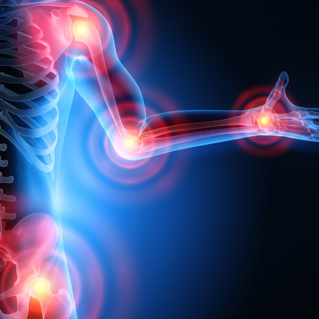 Getting To Know Your Joints