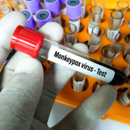 Malaysia's Plan To Manage Monkeypox