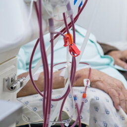 “Ya ha pasado que los pacientes con diálisis se han quedado sin tratamiento por la falta de agua”: Experta