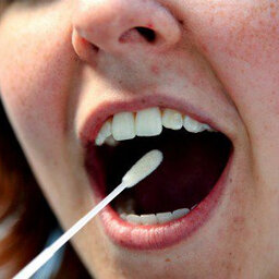 4 Crucial Things Your Saliva Can Tell You About Your Hormones.