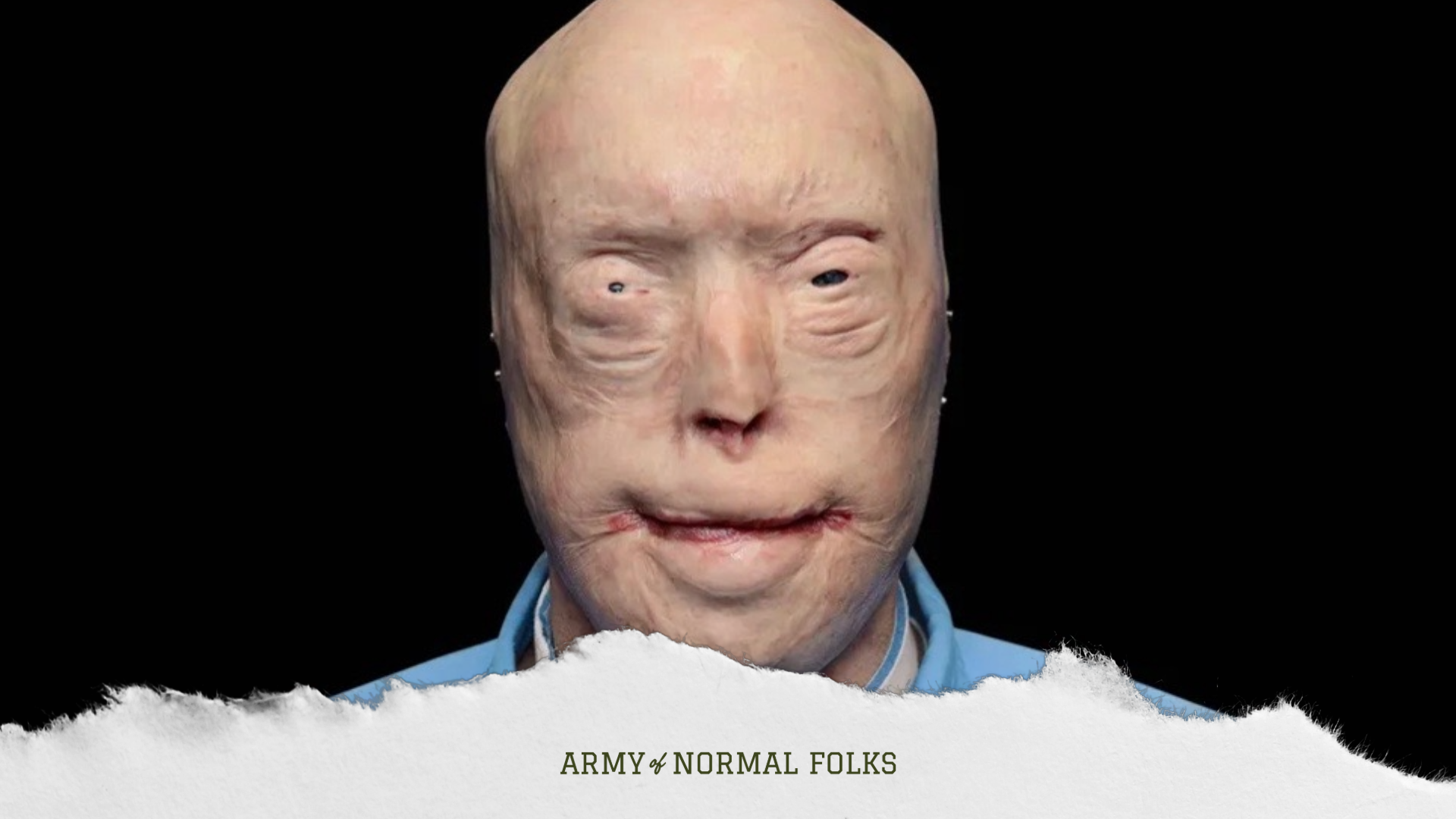 How To Keep Going: When You Literally Lose Your Face. Or Anything Else (Pt 2) episode artwork