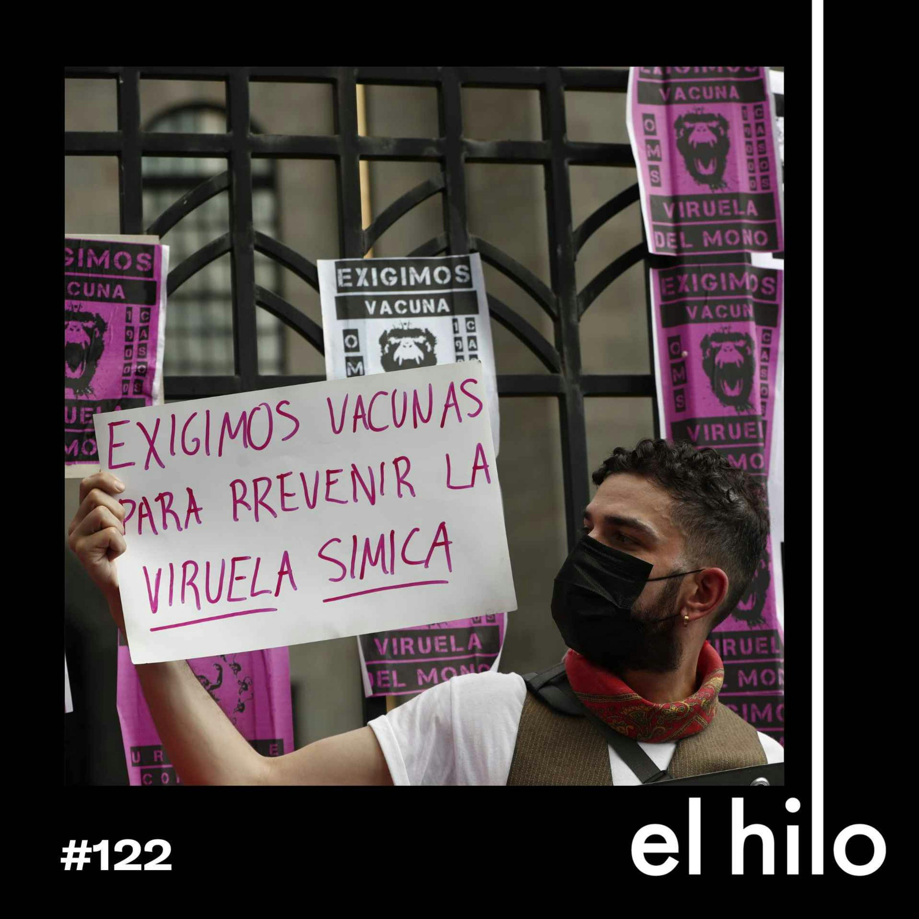 Lo que debes saber sobre la viruela del mono