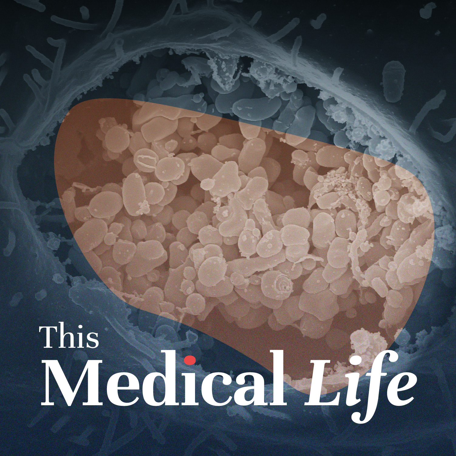 Episode 16: Q (Query) Fever | The Abbatoir Ailment & Coxiella Burnetti