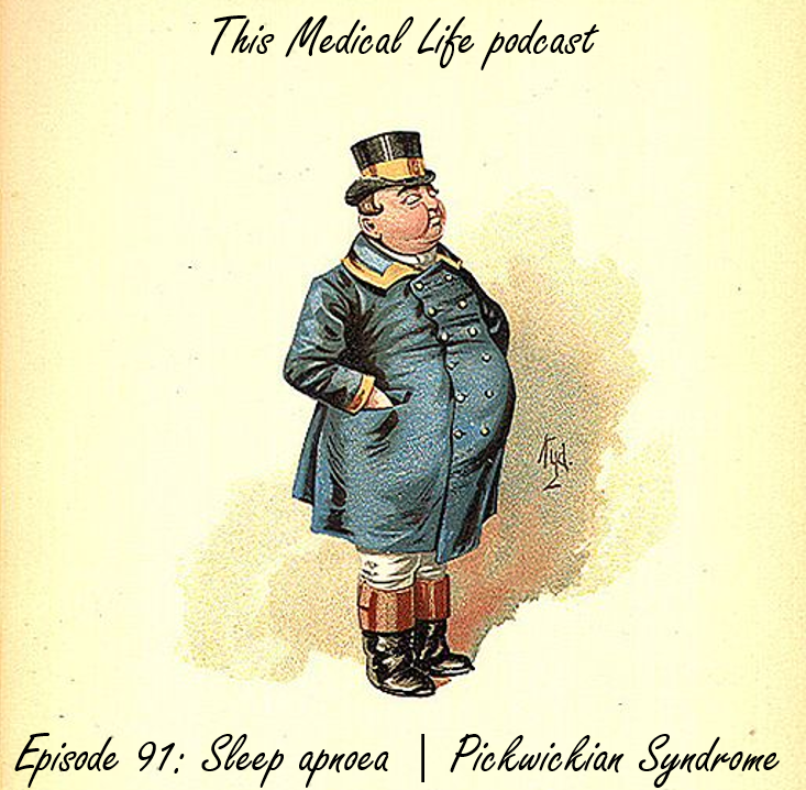 Episode 91: Sleep Apnoea | Pickwickian Syndrome