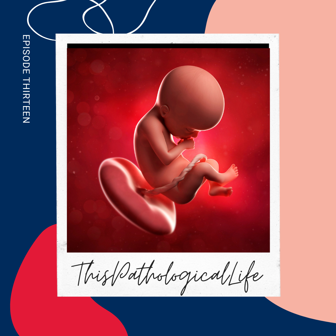 Ep 13 Chromosomal Abnormalities Pathology | Survivable triplicates