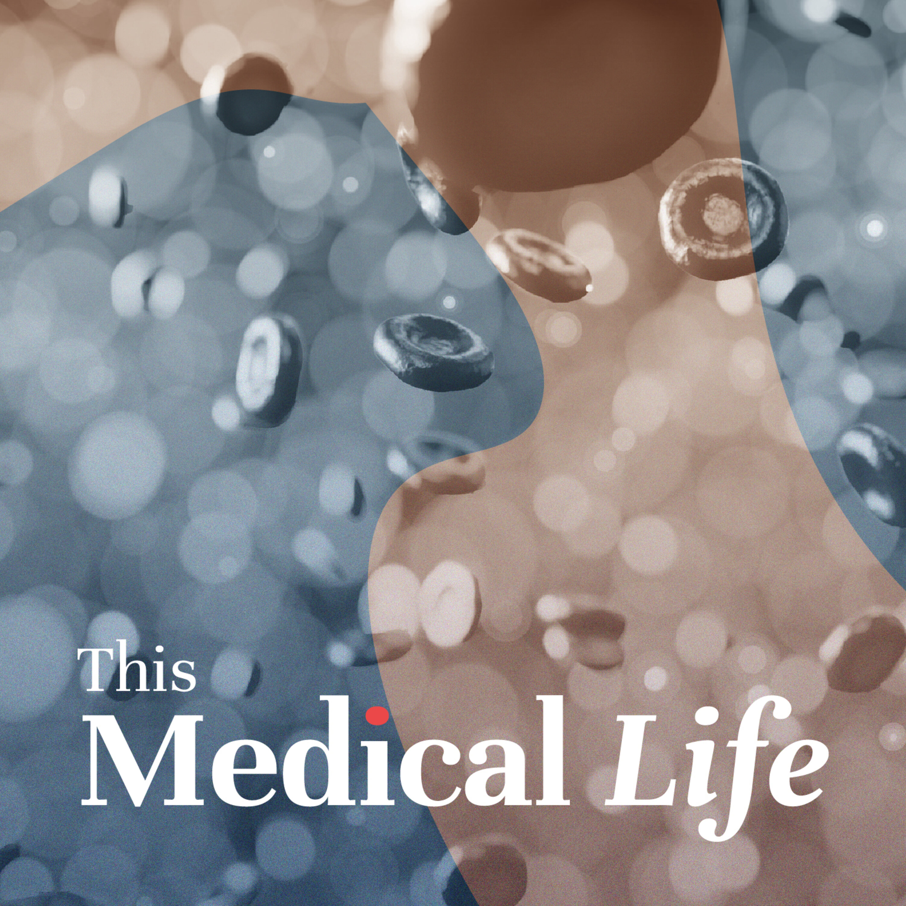 Episode 12 : Idiopathic Thrombocytopenia Purpura (ITP) | Putting the 'I' in ITP